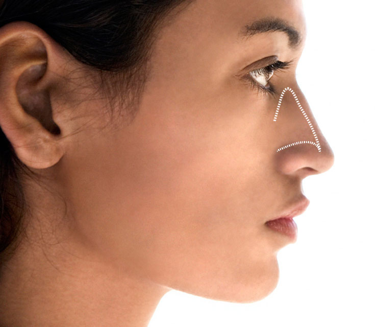 【裁断済】Rhinoplasty (鼻整形) I ジョン・ドンハク Zetith Beauty Clinic 鉄理事長による鼻整形の教科書が待望の第